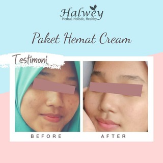 TESTIMONI HALWEY